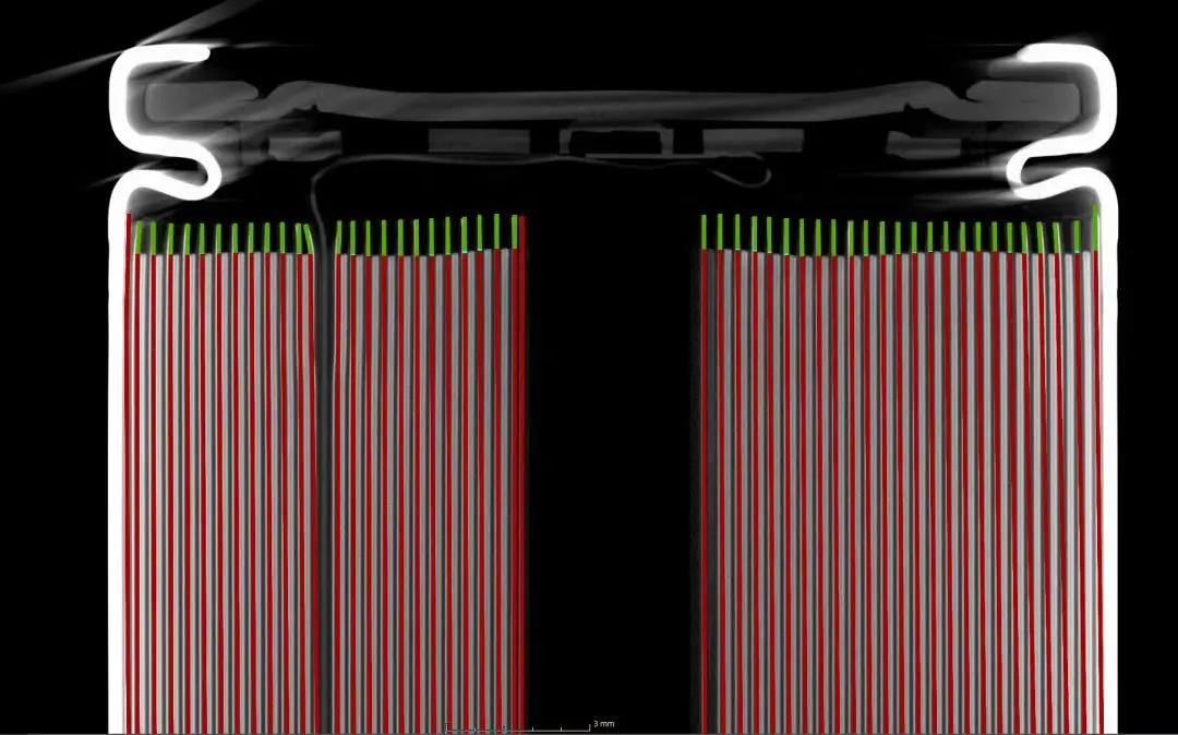 CT slice of a round battery cell showing electrode overhang