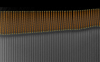 Electrode overhang detected by Royma inline CT